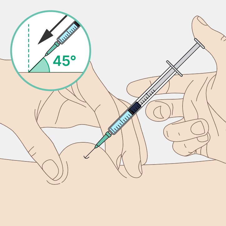 Inserisci a 45°